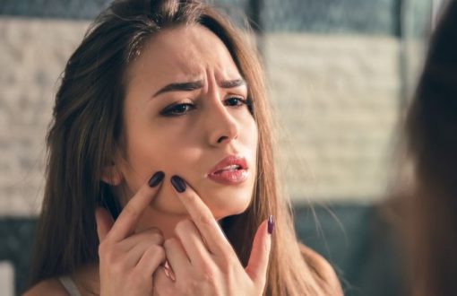 period-effects-on-skin-hair-1